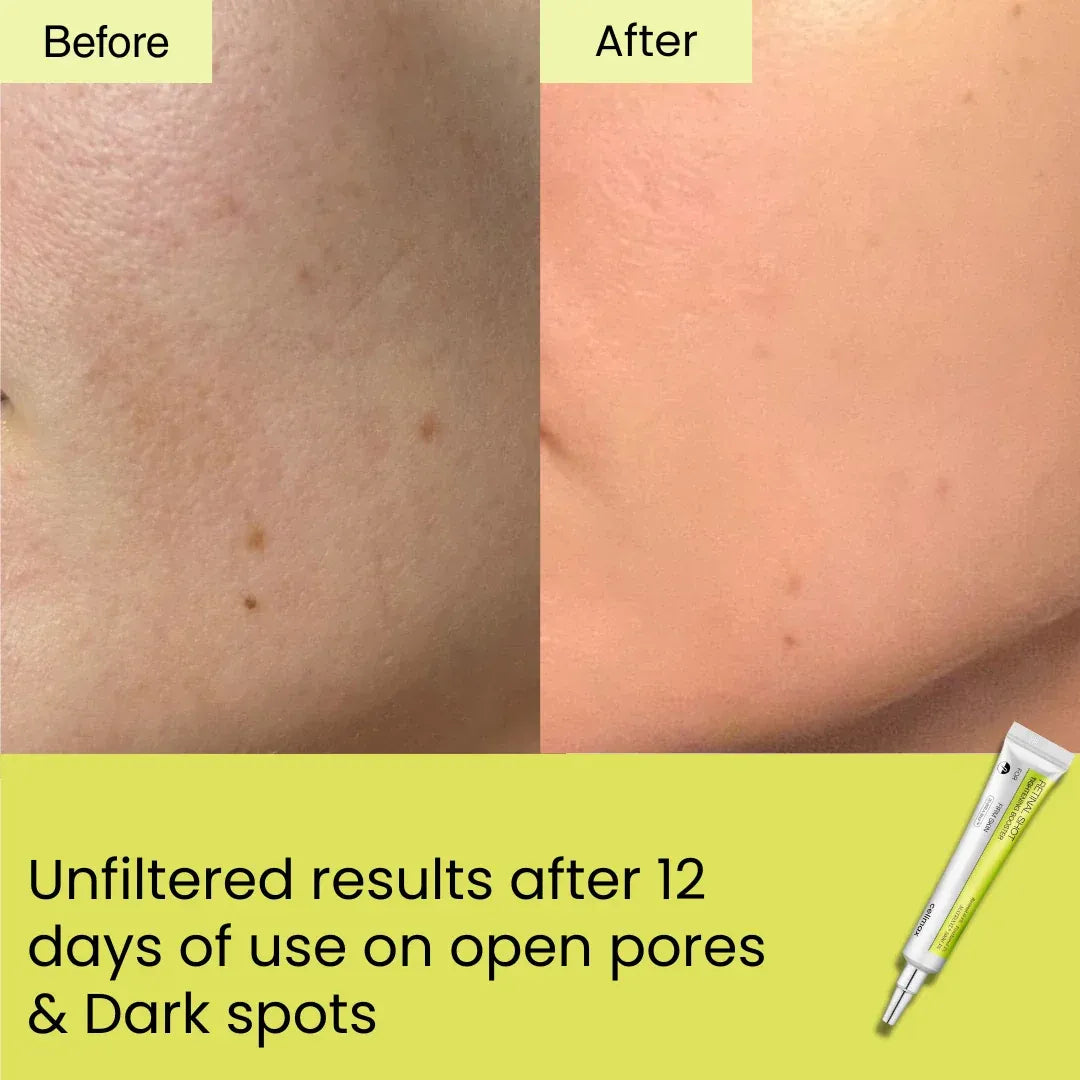 Celamix Retinal Shot – Advanced Anti-Aging Retinal Shot for Firm & Smooth Skin